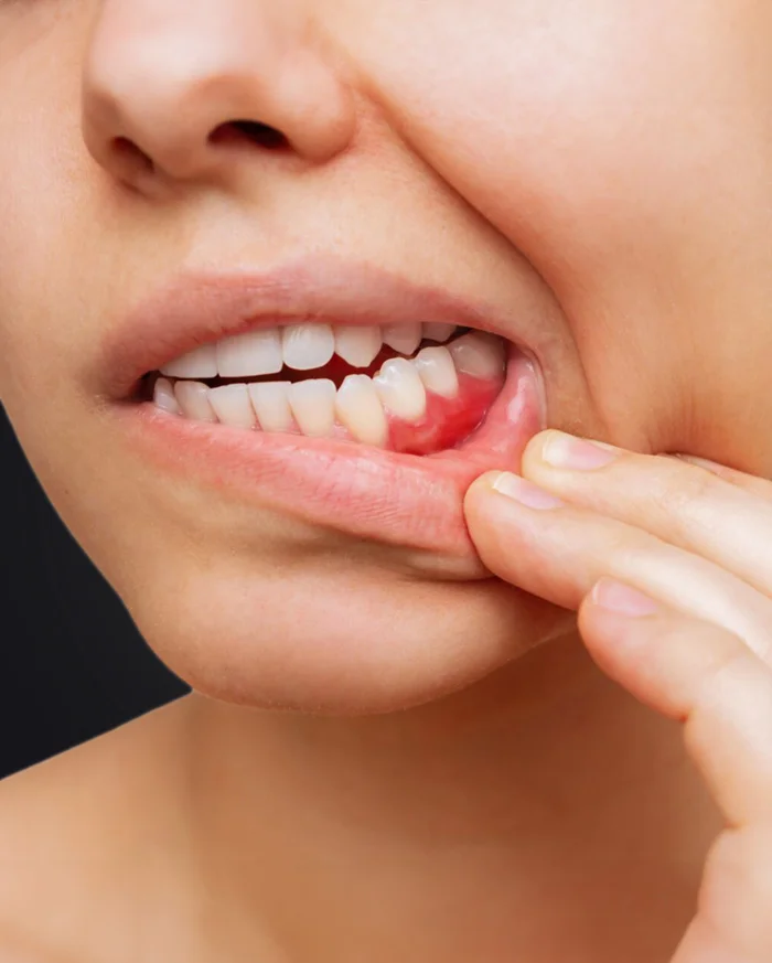 Periodontoloji